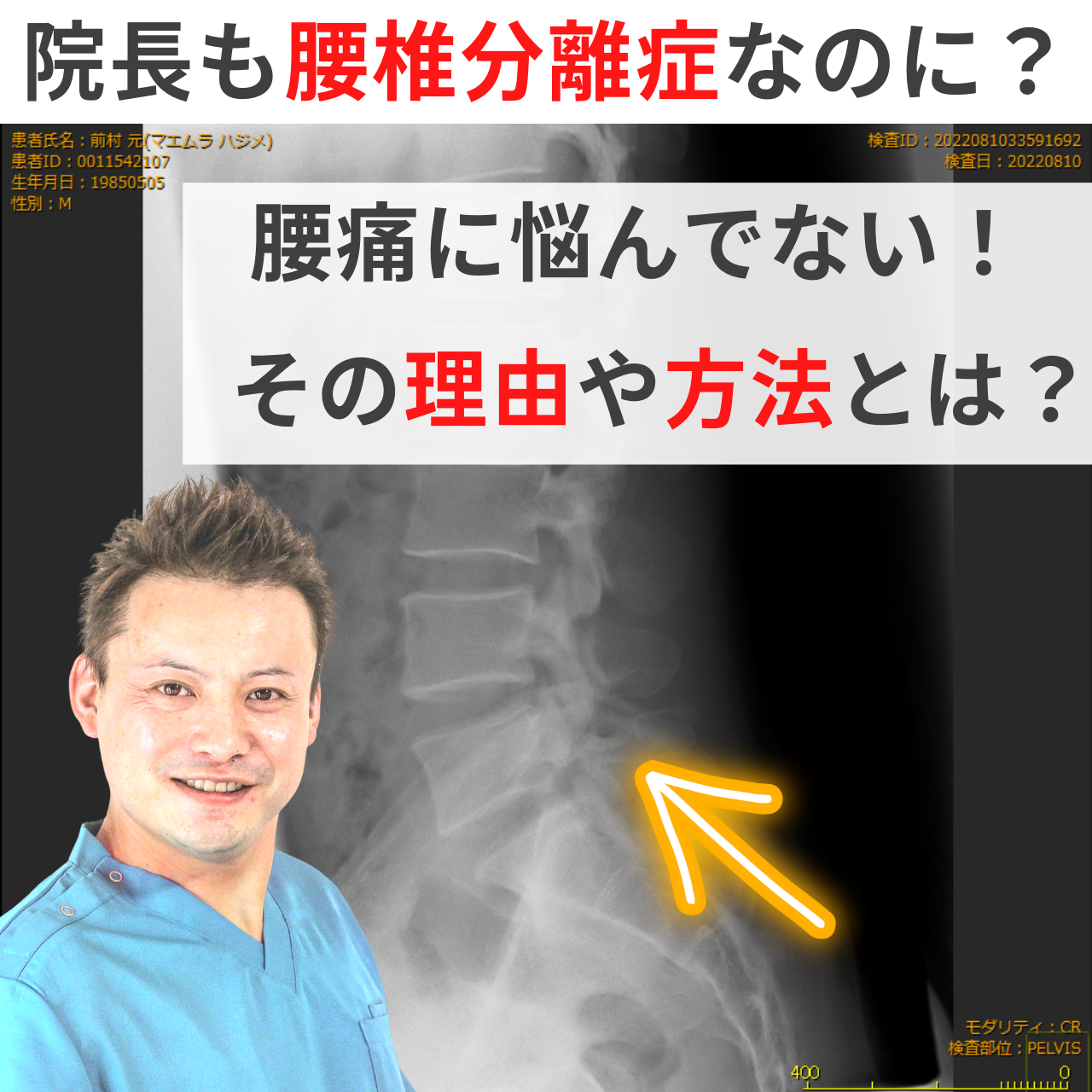 滋賀県大津市あゆは整体院整骨院腰椎分離症