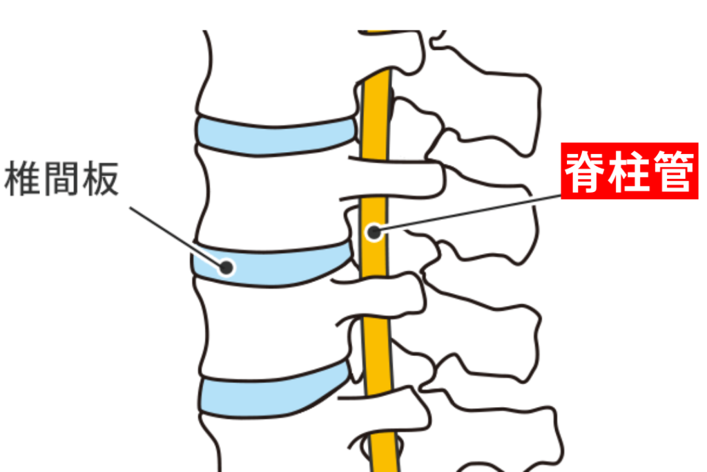 脊柱管の構造を骨の側面から説明している画像